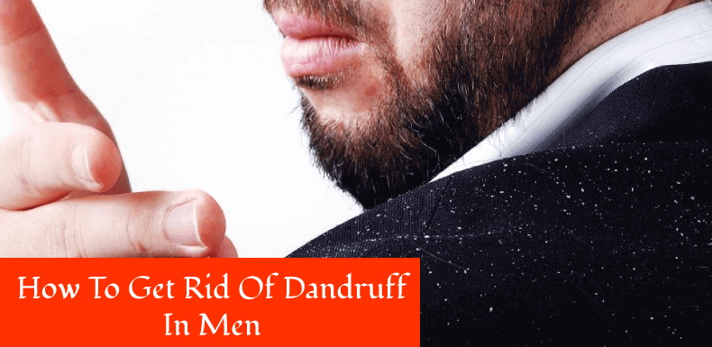Solution for dandruff in men