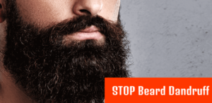 STOP Beard Dandruff - How To Get Rid of Beard Dandruff