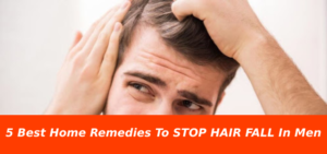 Home Remedies To STOP HAIR FALL In Men